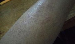 一只麻瓜吃鸡皮肤好看吗,探究鸡皮肤的美学价值